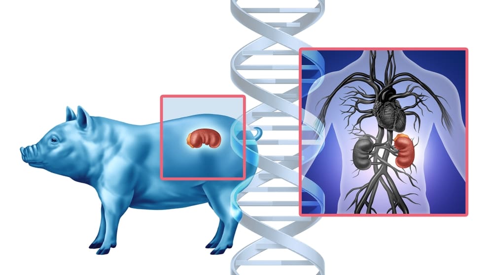 Überblick zur Nierentransplantation von Schweinen